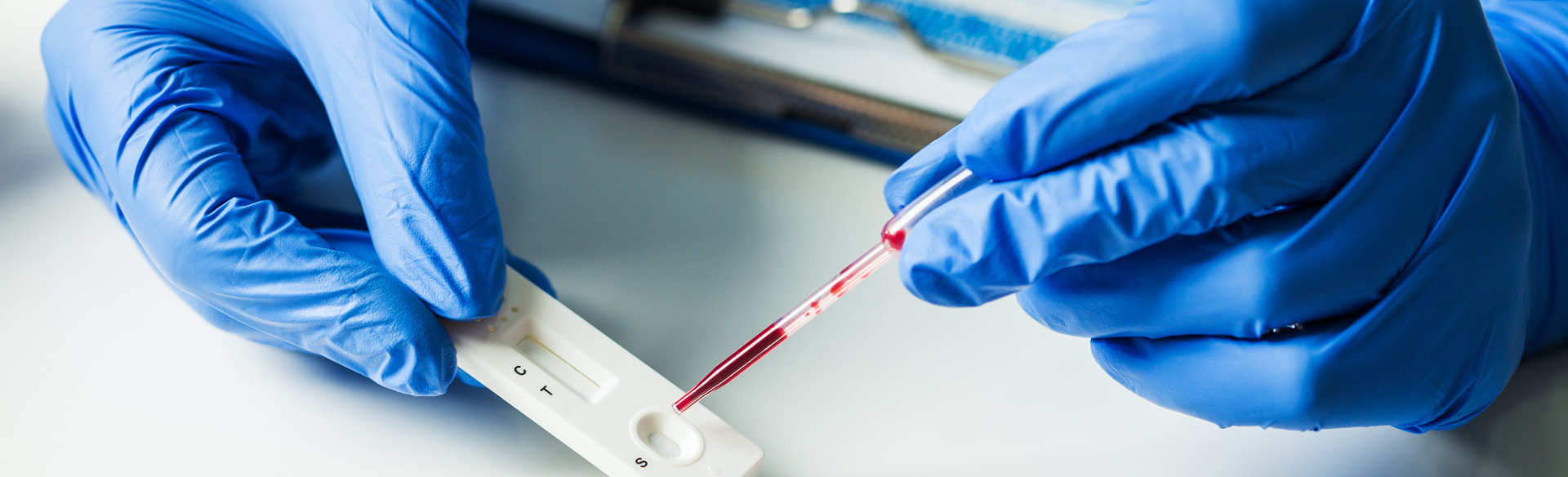 point of care testing