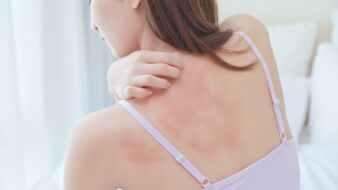 woman scratching her back