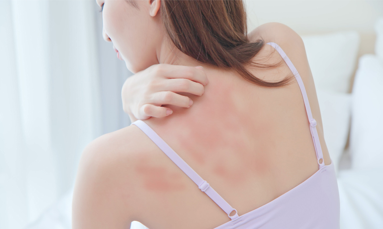 woman scratching her back