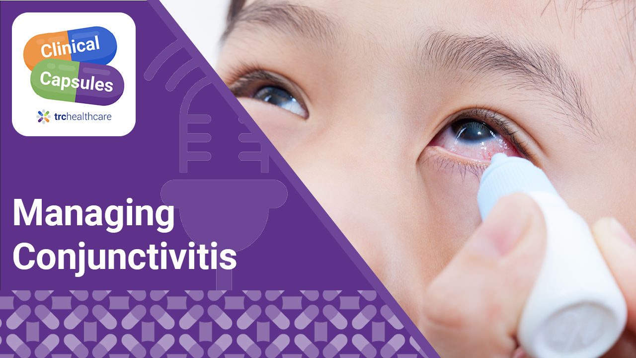 Clinical Capsules Managing Conjunctivitis