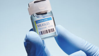 measles vaccine